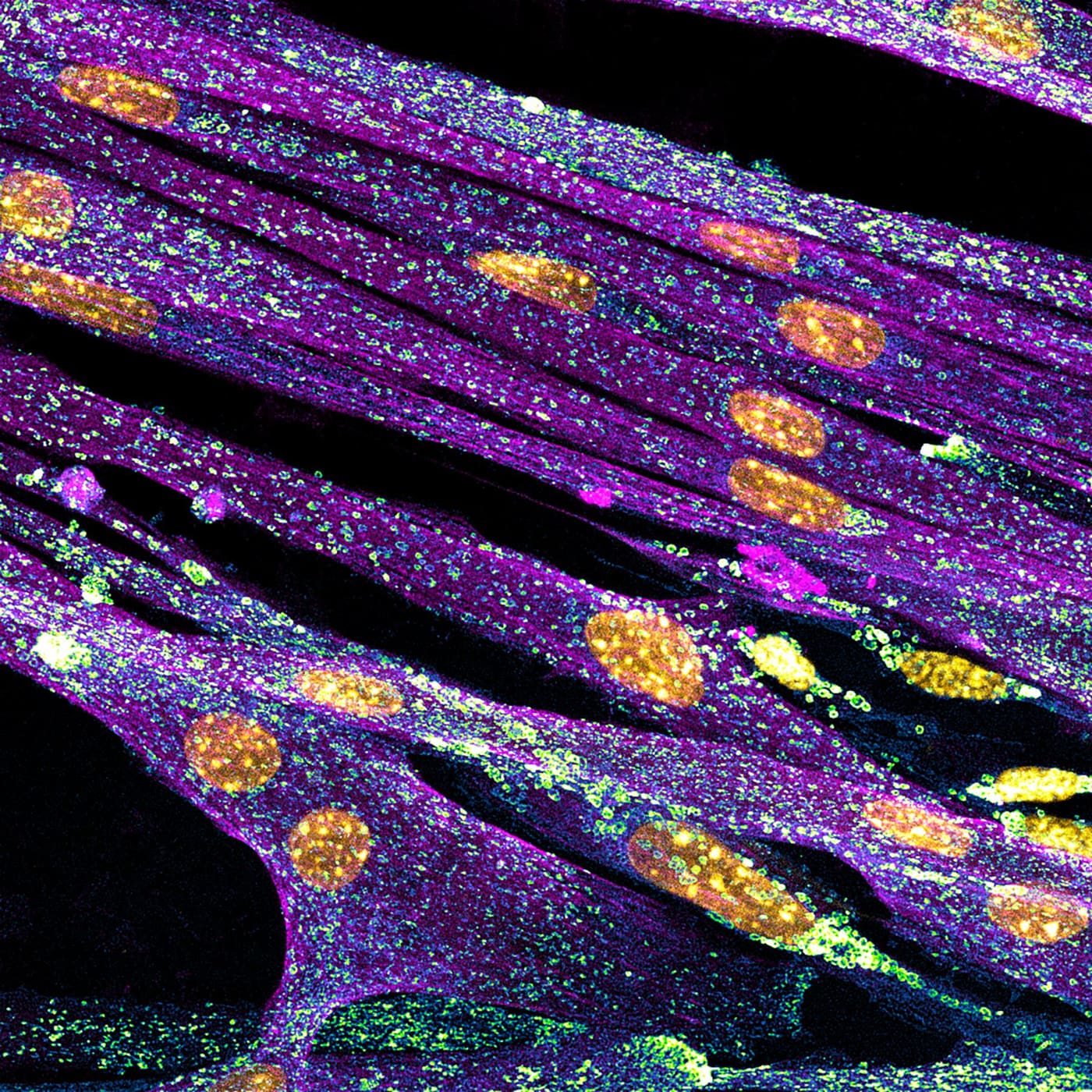 Fluorescence micrograph of cells, showing the cytoskeleton and nuclei