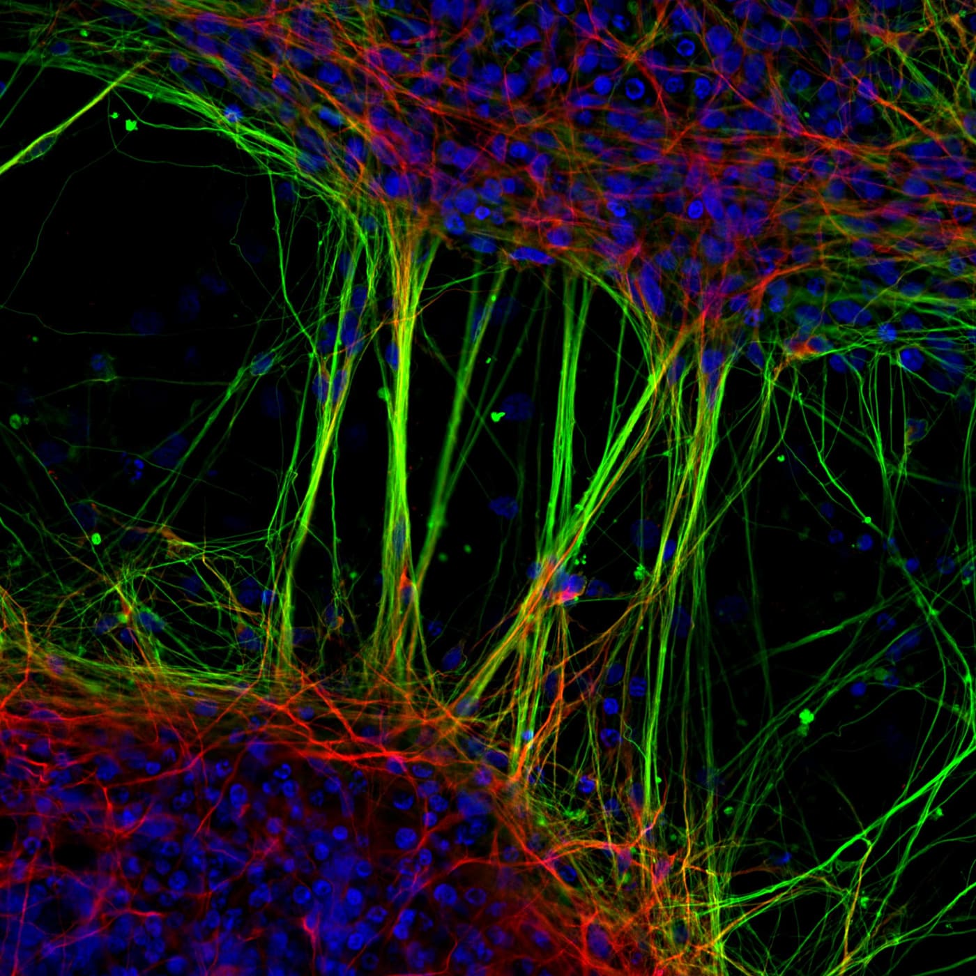 Fluorescence micrograph of a neural network, showing cell bodies and their projections