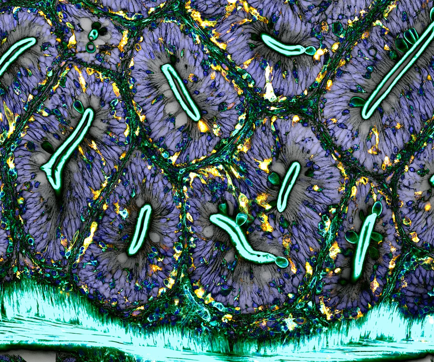 Fluorescence micrograph of intestinal villi, showing the epithelial barrier and the immune cells beneath it